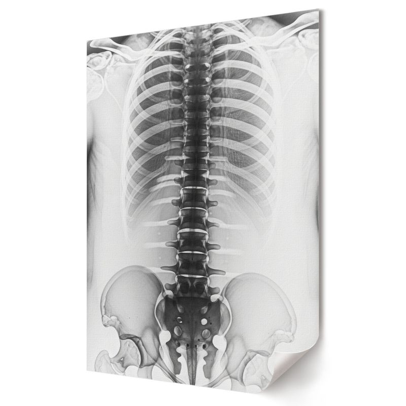 Plakat canvas Wallfluent Format A4 Zdjęcie rentgenowskie Kolektyw Soft Structure 1 szt.