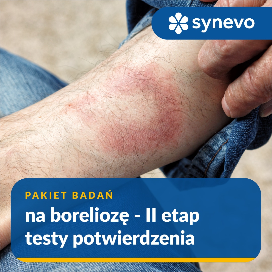 Pakiet badań na boreliozę – II etap (testy potwierdzenia)